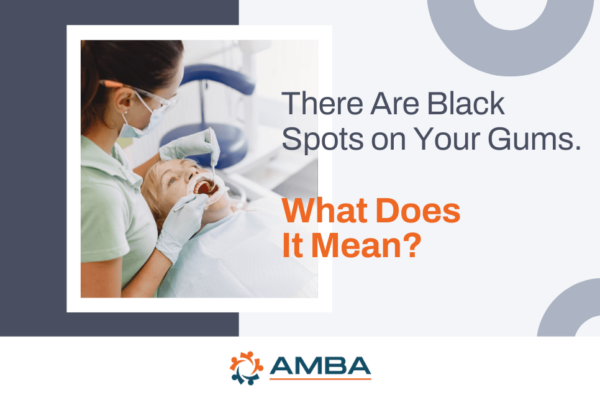 There Are Black Spots on Your Gums. What Does It Mean?